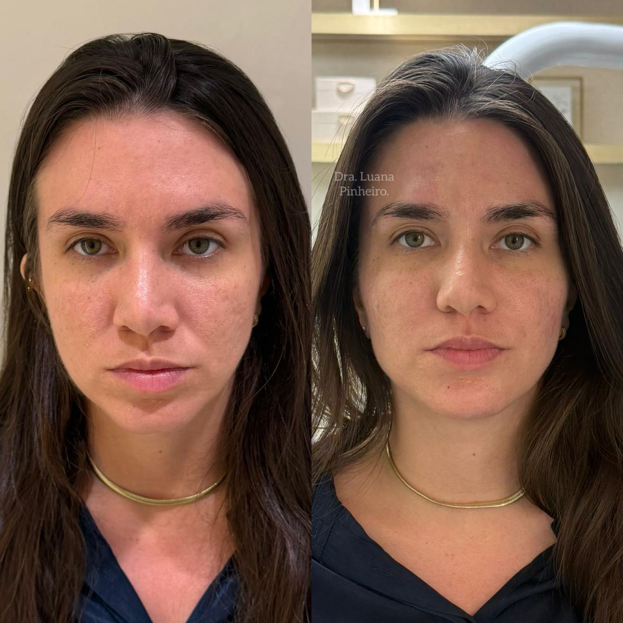 Skinbooster